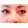 Eyelash extensions - bukett... at Klinik Hallandson