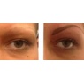 Permanent makeup at Ingves Klinik